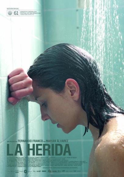 -La Herida-, de Fernando Franco.
